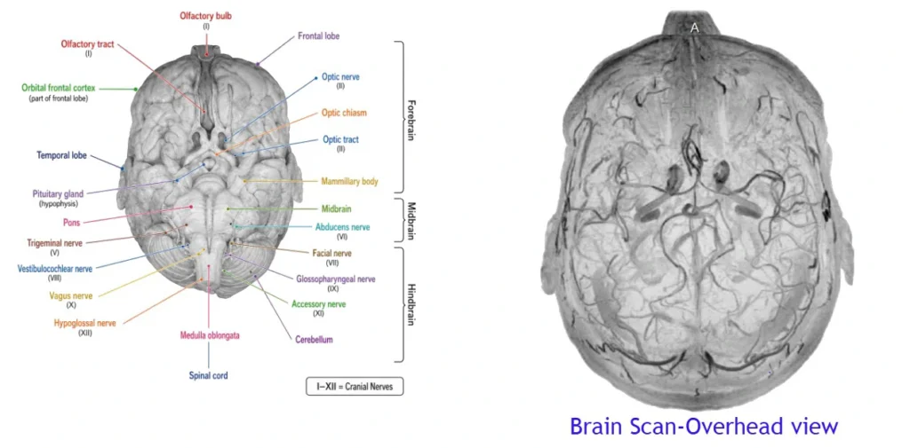 ImgResizer Brain Scan Angiogram With Brain Anatomy Diagram